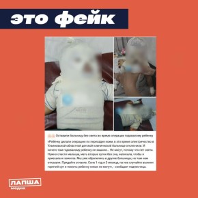 В Сети пишут, якобы в Ульяновской детской клинической больнице годовалому ребенку не доделали операцию по пересадке кожи из-за отключения электричества
