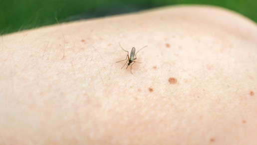 Комариные укусы вас больше не побеспокоят: вот как избавиться от зуда