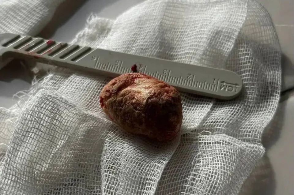 ������� ������� ��������� ������ �� ������� ������ �������� � ������� ����